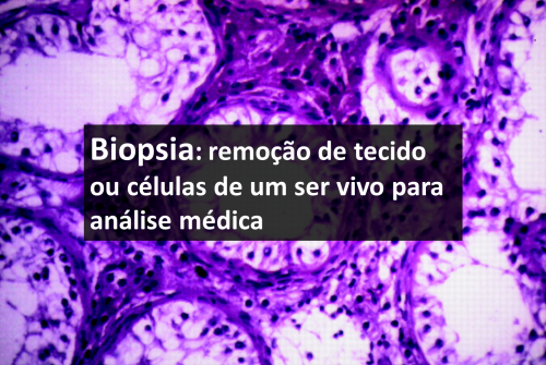 biopsia